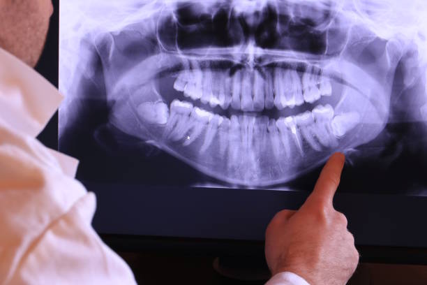 Best Urgent Care for Lost Fillings or Crowns in Somerset, TX