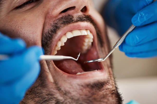 Best Same-Day Emergency Dental Services in Somerset, TX